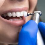 Rituál čištění zubů: Od základů po mistrovské tipy